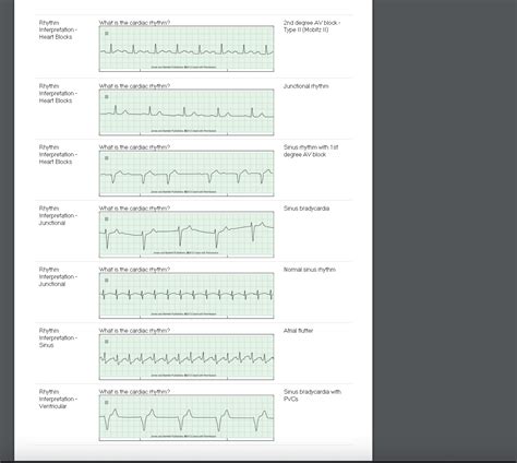 The following are some general guidelines. . Relias ekg test answers